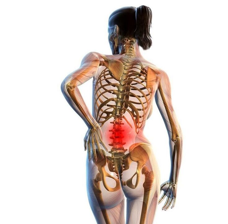Dor lumbar