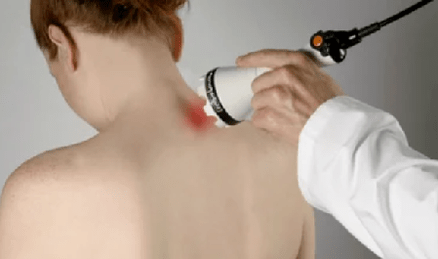 tratamento da osteocondrose cervical mediante métodos de fisioterapia
