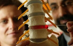 Síntomas e tratamento da osteocondrose da columna vertebral torácica