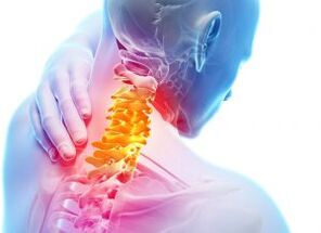 Dor e tiroteo na zona cervical con osteocondrose de terceiro grao